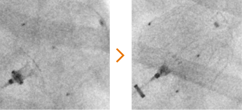 Improved assessment of device anchoring when performing tug test