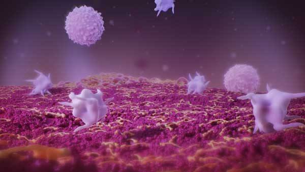 Acute inflammation image.